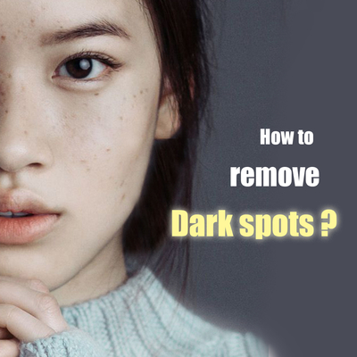 [:en]darkspots[:]