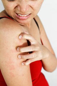 Skin allergy treatments