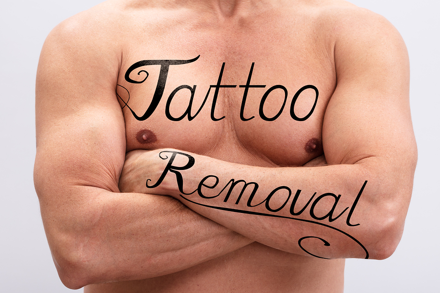 [:en]bigstock Tattoo Removal Text On Man s B 282937174[:]