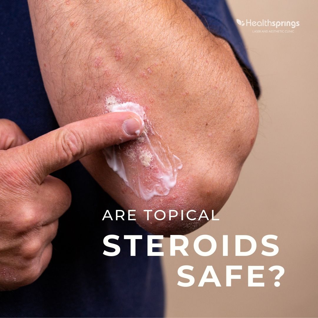 [:en]steroids[:]