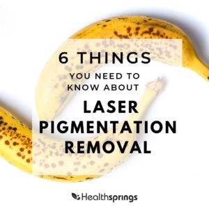 Laser Pigmentation Removal