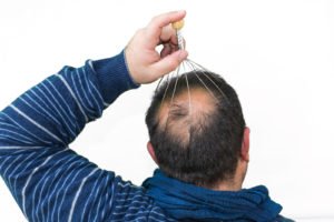 hair