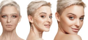 Non-surgical facelift