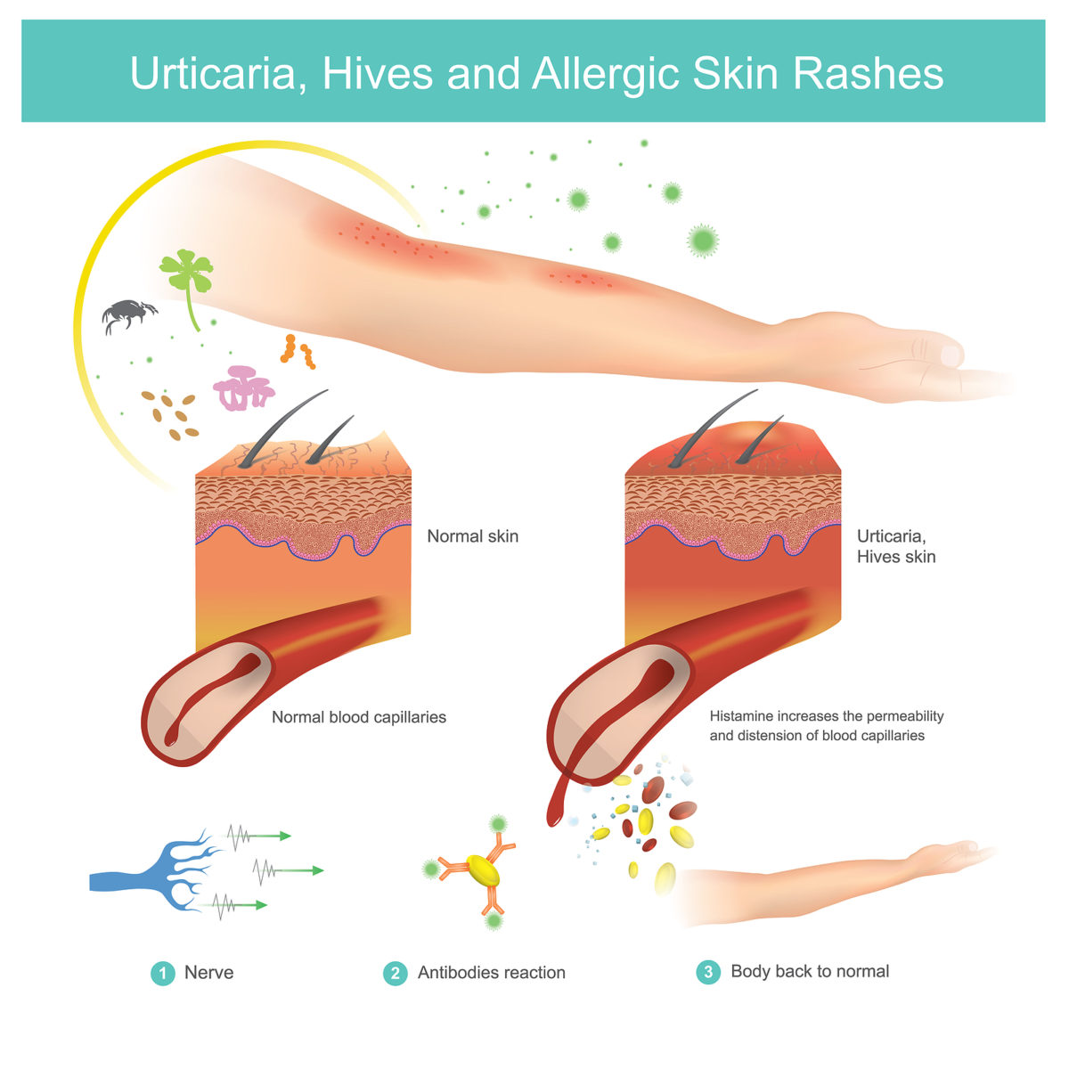 4 Common Mistakes People Make With Skin Allergy Treatment Healthsprings