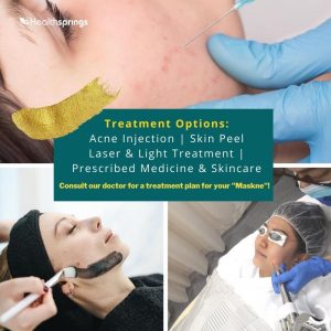 Broadband light (BBL) and laser treatments