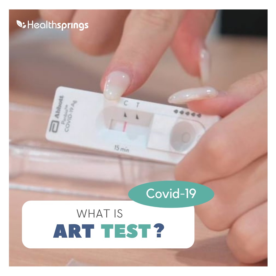 [:en]ART test[:]