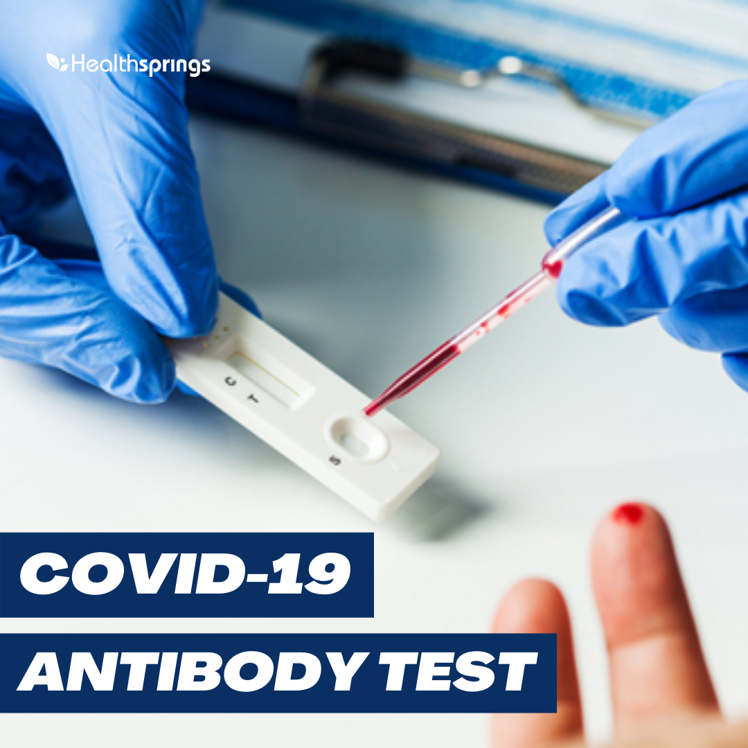 [:en]covid antibody test[:]