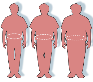 Obesity